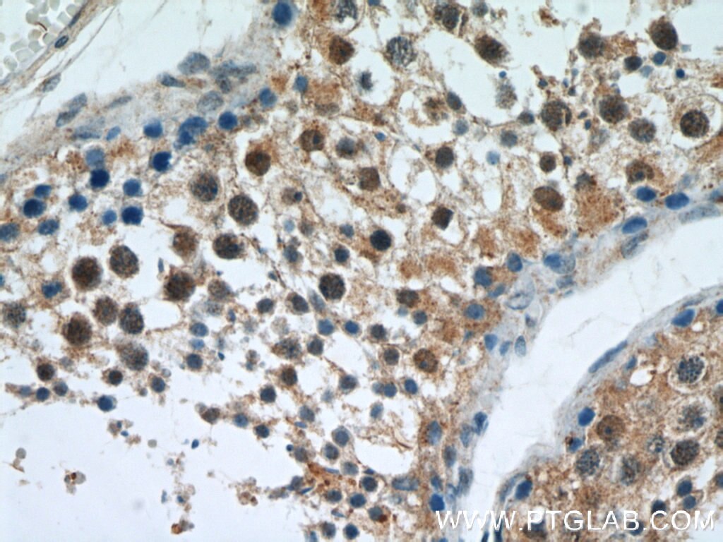 Immunohistochemistry (IHC) staining of human testis tissue using APC1 Polyclonal antibody (21748-1-AP)