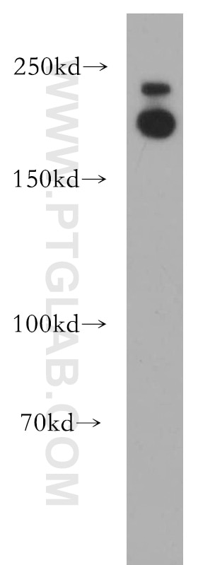 Western Blot (WB) analysis of HT-1080 cells using APC1 Polyclonal antibody (21748-1-AP)