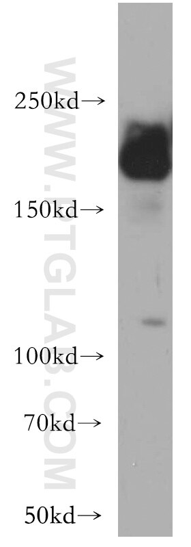 Western Blot (WB) analysis of HEK-293 cells using APC1 Polyclonal antibody (21748-1-AP)