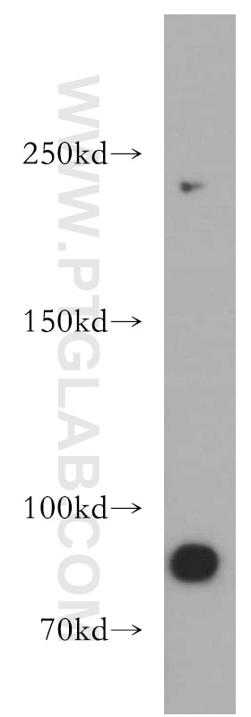 Western Blot (WB) analysis of mouse brain tissue using APC1 Polyclonal antibody (21748-1-AP)