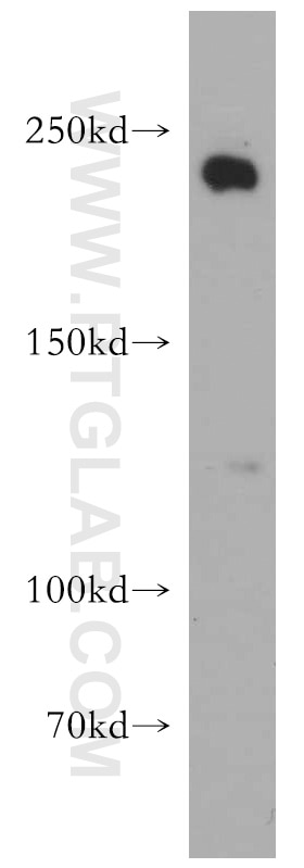 Western Blot (WB) analysis of HeLa cells using APC1 Polyclonal antibody (21748-1-AP)