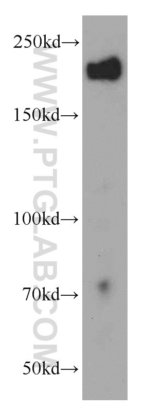 Western Blot (WB) analysis of K-562 cells using APC1 Polyclonal antibody (21748-1-AP)