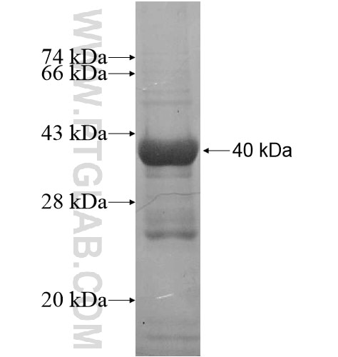 ANAPC1 fusion protein Ag13399 SDS-PAGE