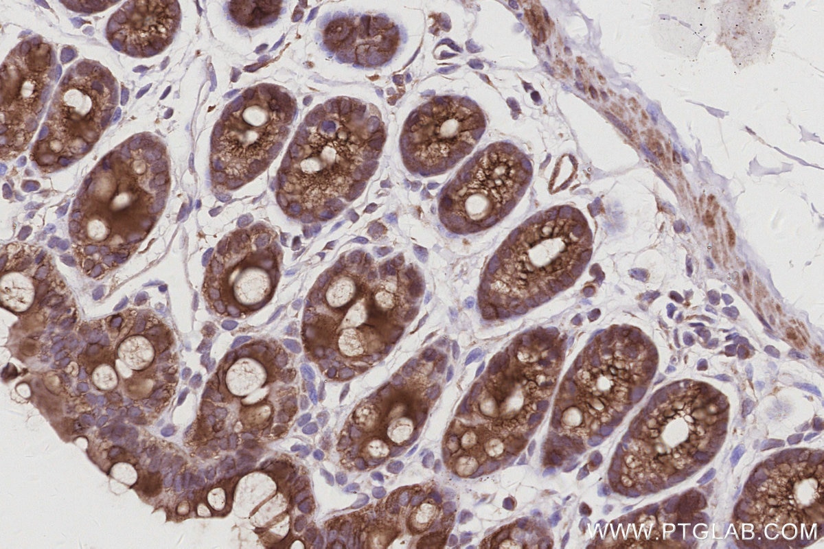 IHC staining of mouse colon using 15788-1-AP Immunohistochemistry (IHC) staining of mouse colon tissue using ANAPC10 Polyclonal antibody (15788-1-AP)