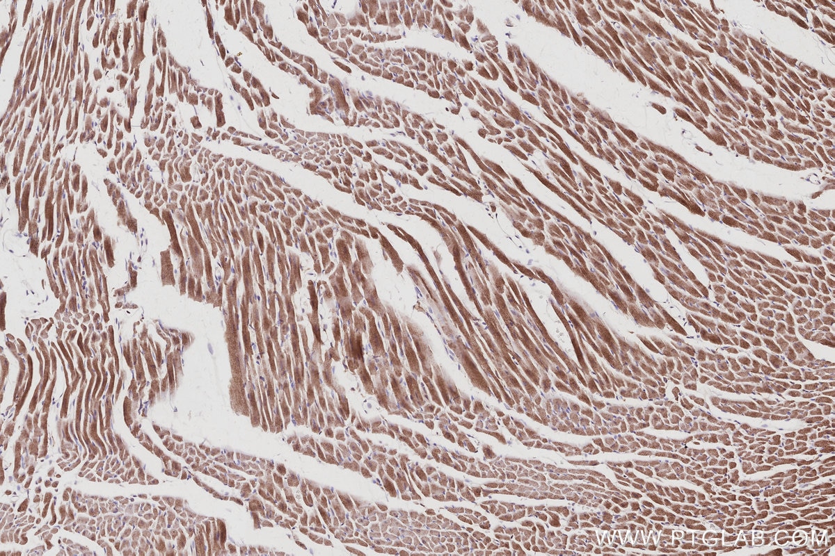 IHC staining of rat heart using 15788-1-AP Immunohistochemistry (IHC) staining of rat heart tissue using ANAPC10 Polyclonal antibody (15788-1-AP)