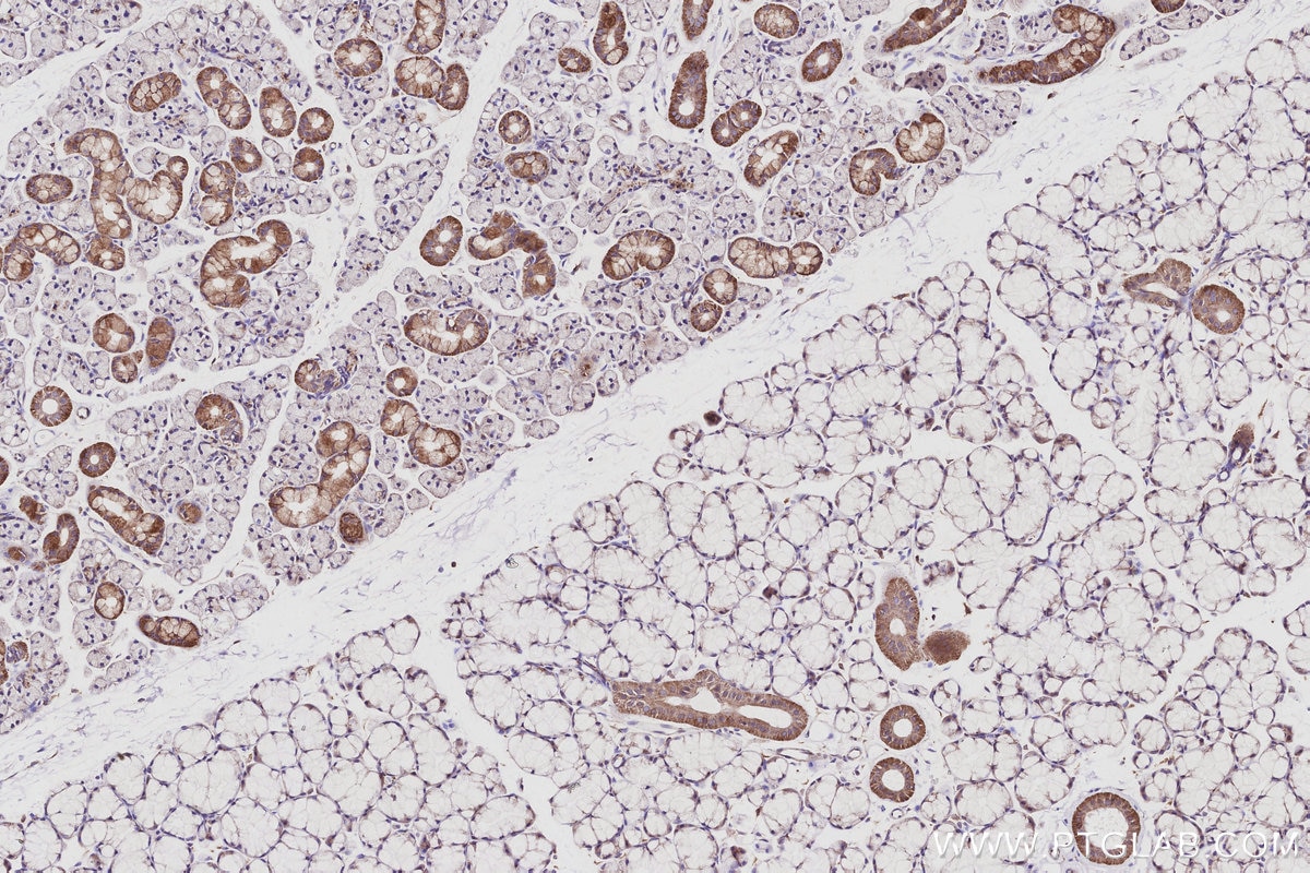 IHC staining of rat salivary gland using 15788-1-AP Immunohistochemistry (IHC) staining of rat salivary gland tissue using ANAPC10 Polyclonal antibody (15788-1-AP)
