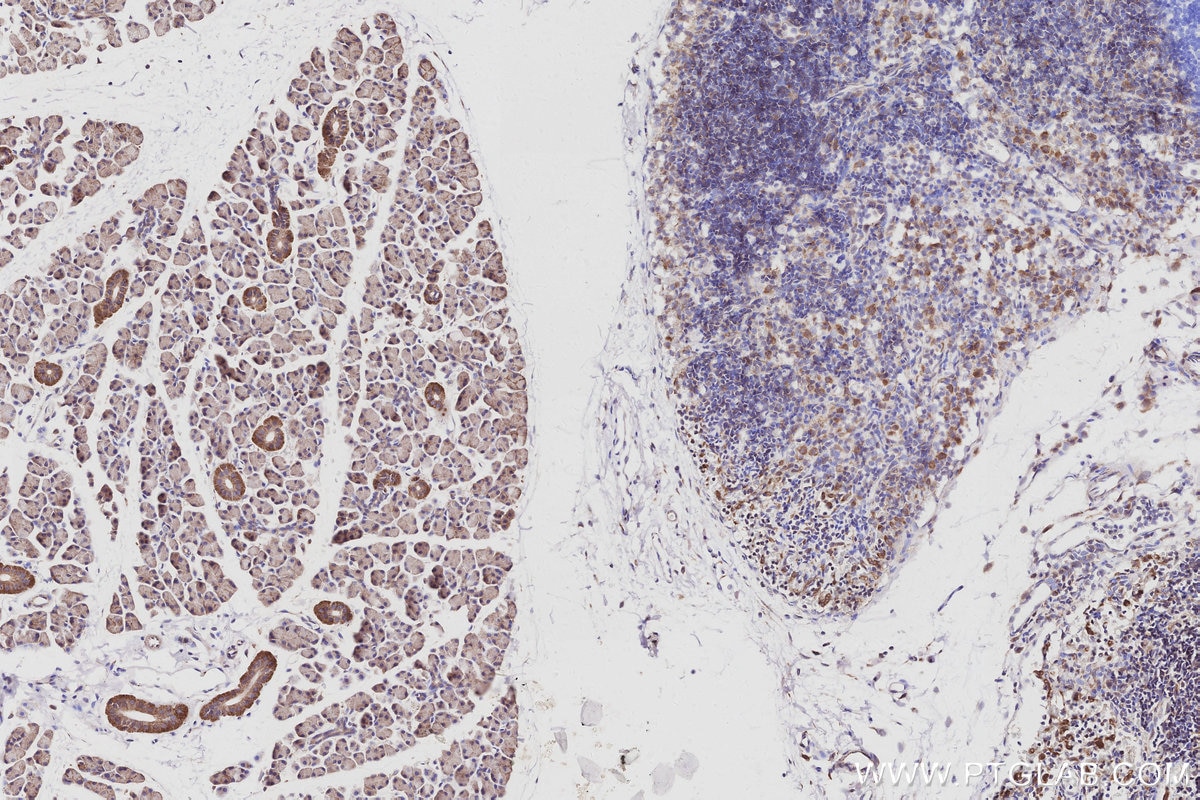 IHC staining of rat salivary gland using 15788-1-AP Immunohistochemistry (IHC) staining of rat salivary gland tissue using ANAPC10 Polyclonal antibody (15788-1-AP)