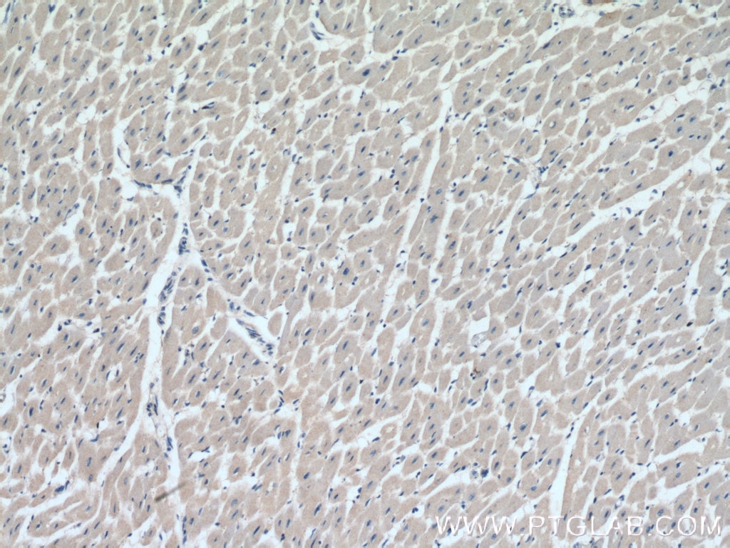 Immunohistochemistry (IHC) staining of human heart tissue using ANAPC10 Polyclonal antibody (15788-1-AP)