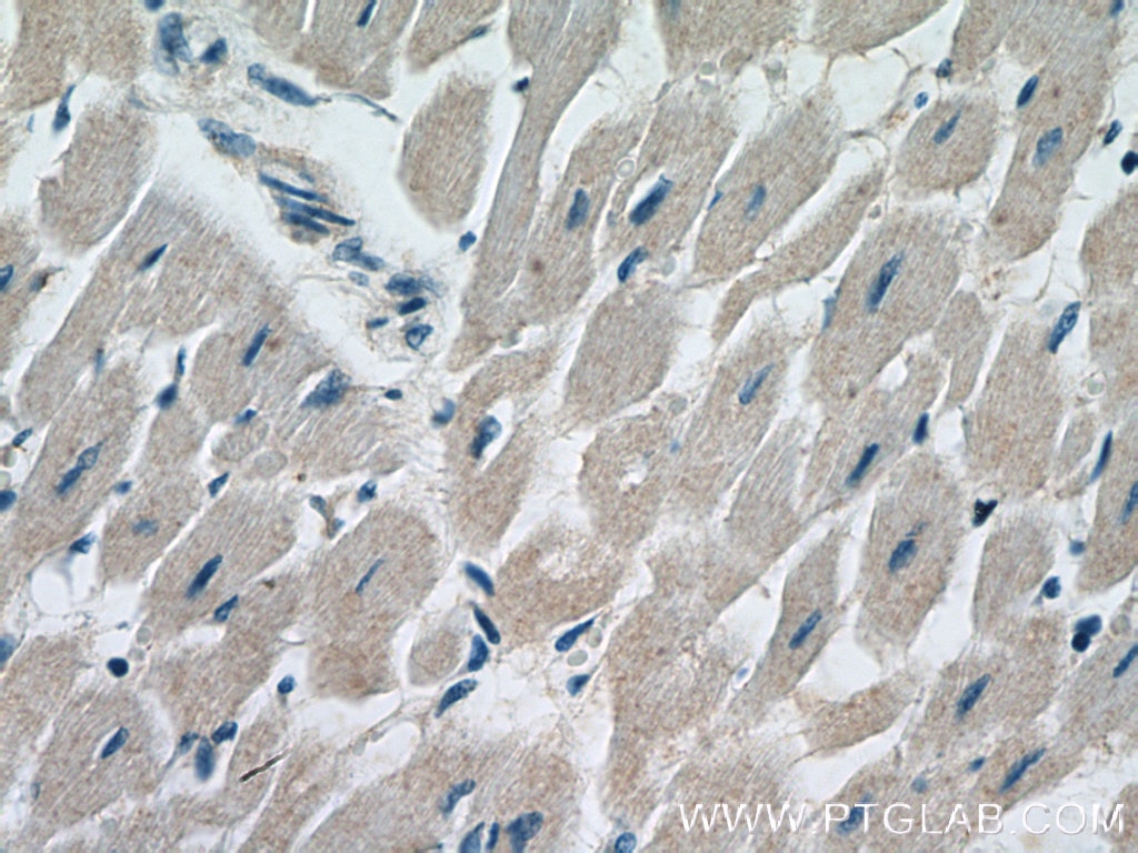 Immunohistochemistry (IHC) staining of human heart tissue using ANAPC10 Polyclonal antibody (15788-1-AP)