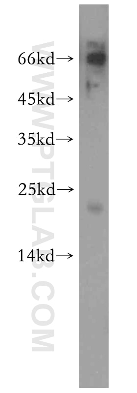 Western Blot (WB) analysis of A549 cells using APC11 Polyclonal antibody (15065-1-AP)