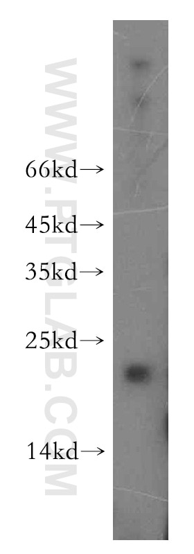 Western Blot (WB) analysis of mouse pancreas tissue using APC11 Polyclonal antibody (15065-1-AP)