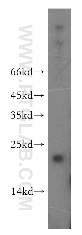 WB analysis of mouse pancreas using 15065-1-AP