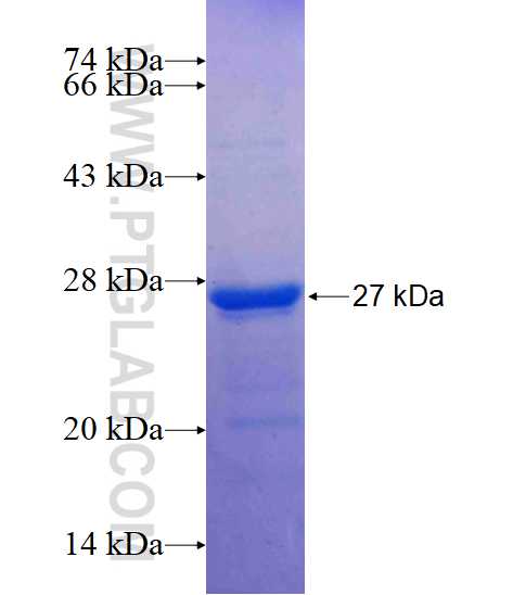ANAPC11 fusion protein Ag14639 SDS-PAGE