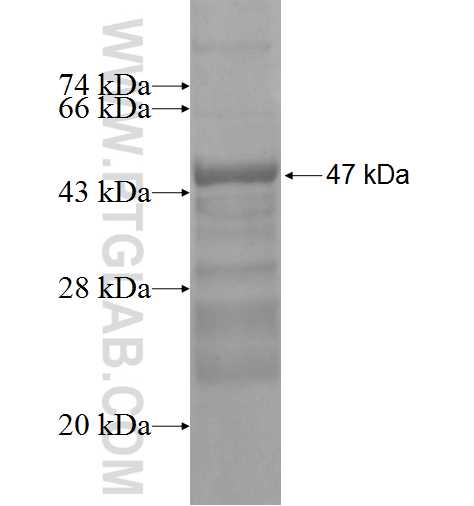 ANAPC11 fusion protein Ag7069 SDS-PAGE
