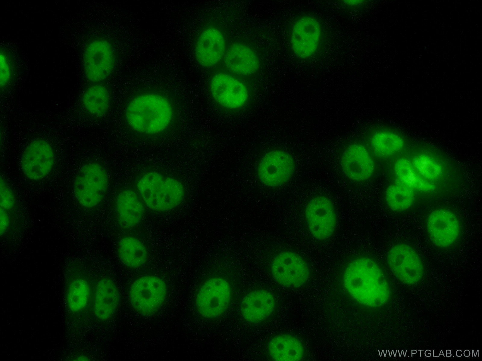 Immunofluorescence (IF) / fluorescent staining of MCF-7 cells using APC2 Polyclonal antibody (13559-1-AP)