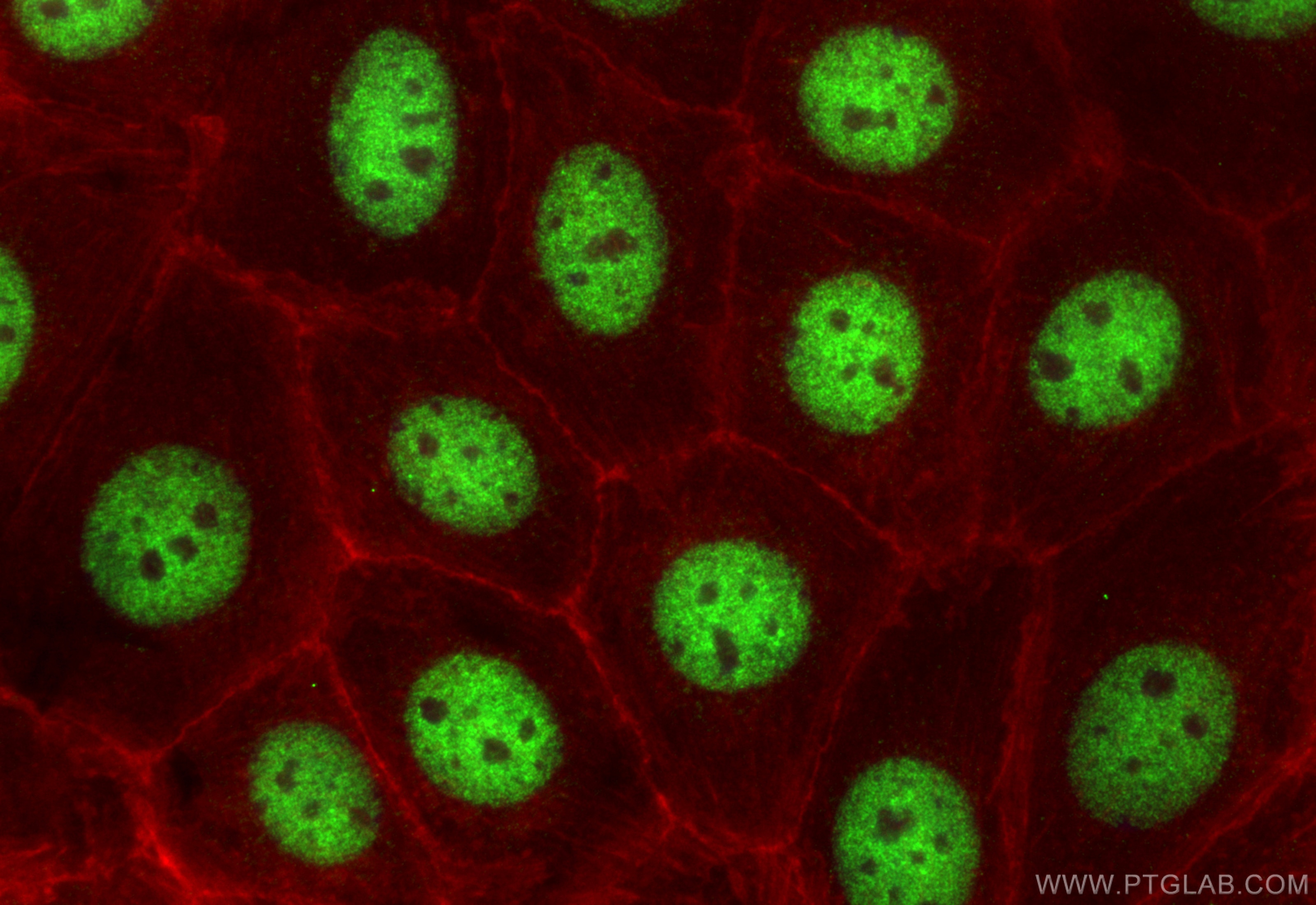Immunofluorescence (IF) / fluorescent staining of MCF-7 cells using APC2 Polyclonal antibody (13559-1-AP)