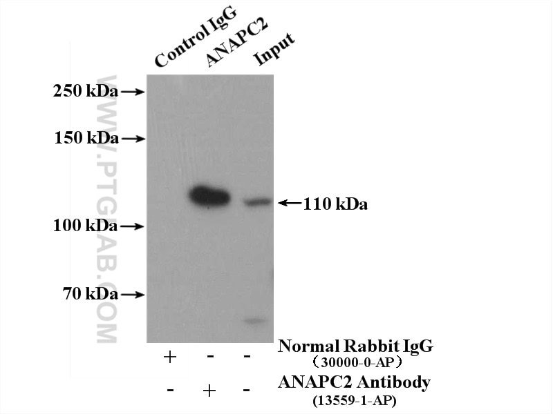Immunoprecipitation (IP) experiment of MCF-7 cells using APC2 Polyclonal antibody (13559-1-AP)
