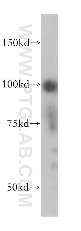 APC2 Polyclonal antibody