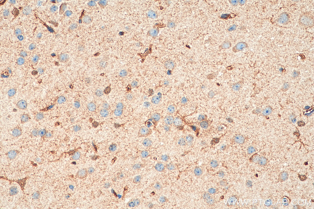 Immunohistochemistry (IHC) staining of mouse brain tissue using APC4 Polyclonal antibody (14129-1-AP)