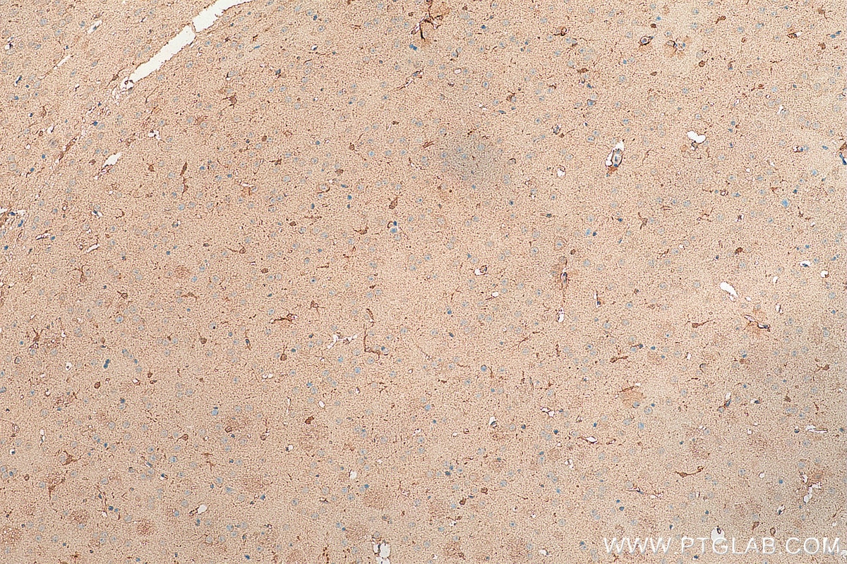 IHC staining of mouse brain using 14129-1-AP