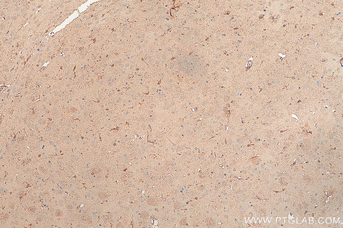 Immunohistochemistry (IHC) staining of mouse brain tissue using APC4 Polyclonal antibody (14129-1-AP)