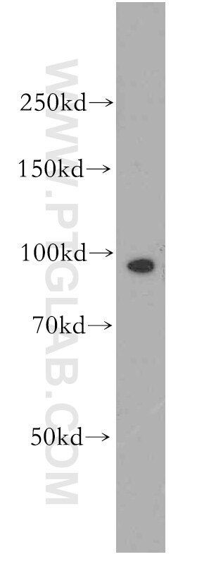 Western Blot (WB) analysis of human brain tissue using APC4 Polyclonal antibody (14129-1-AP)