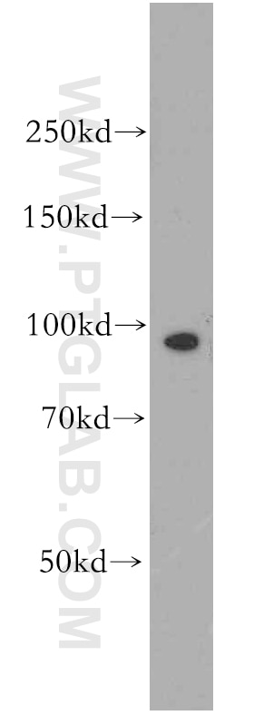 Western Blot (WB) analysis of human brain tissue using APC4 Polyclonal antibody (14129-1-AP)