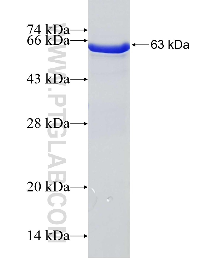 ANAPC4 fusion protein Ag5225 SDS-PAGE