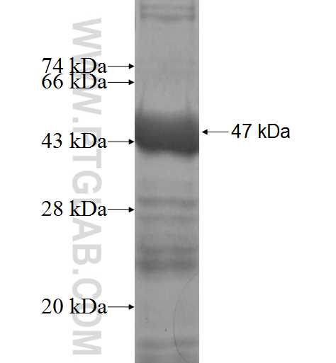 ANAPC4 fusion protein Ag5358 SDS-PAGE