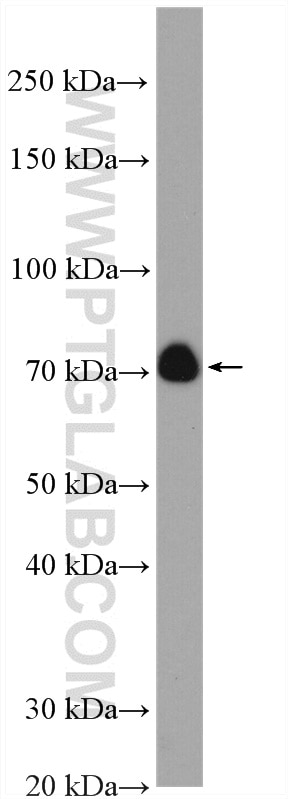 Western Blot (WB) analysis of mouse lung tissue using ANAPC5 Polyclonal antibody (14926-1-AP)