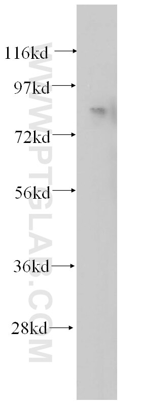 Western Blot (WB) analysis of mouse lung tissue using ANAPC5 Polyclonal antibody (14926-1-AP)