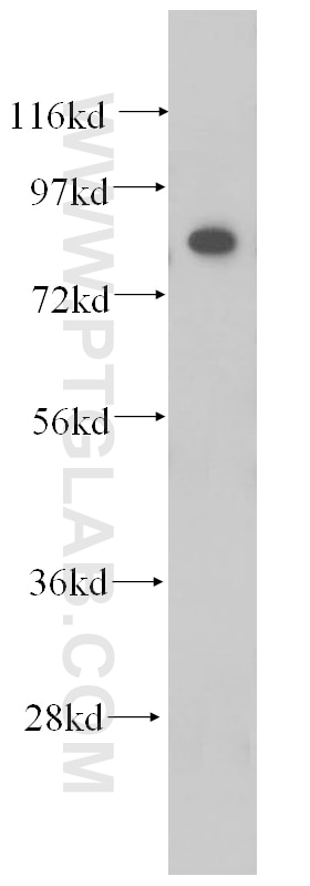 Western Blot (WB) analysis of BxPC-3 cells using ANAPC5 Polyclonal antibody (14926-1-AP)