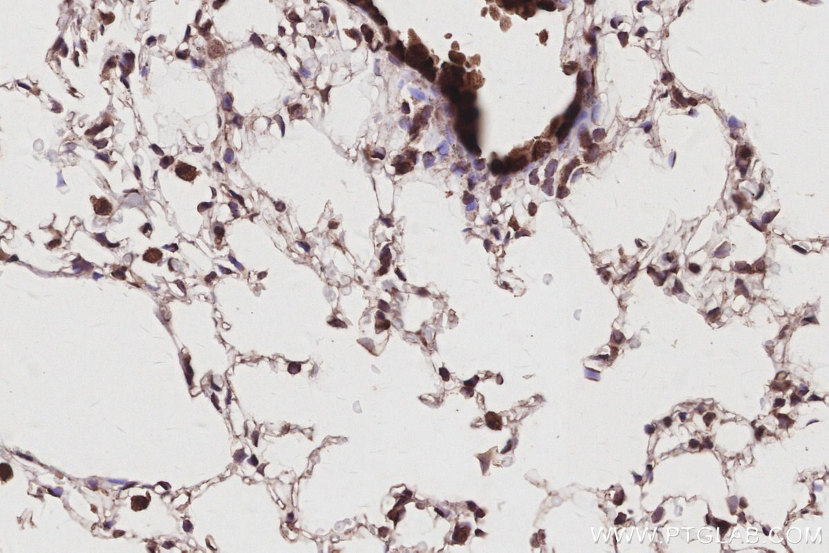 IHC staining of mouse lung using 67348-1-Ig Immunohistochemistry (IHC) staining of mouse lung tissue using ANAPC5 Monoclonal antibody (67348-1-Ig)