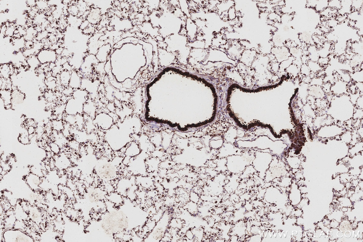 IHC staining of rat lung using 67348-1-Ig Immunohistochemistry (IHC) staining of rat lung tissue using ANAPC5 Monoclonal antibody (67348-1-Ig)