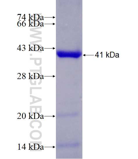 ANAPC5 fusion protein Ag7409 SDS-PAGE
