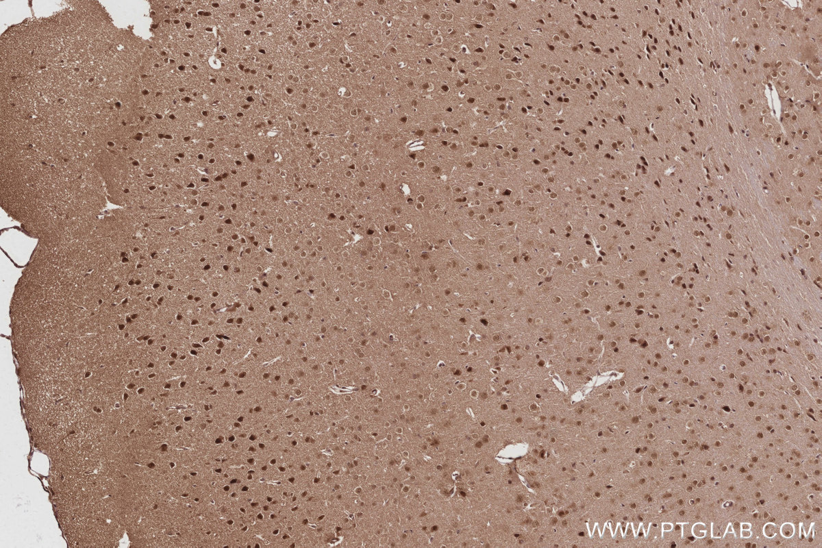 IHC staining of mouse brain using 21761-1-AP Immunohistochemistry (IHC) staining of mouse brain tissue using ANAPC7 Polyclonal antibody (21761-1-AP)
