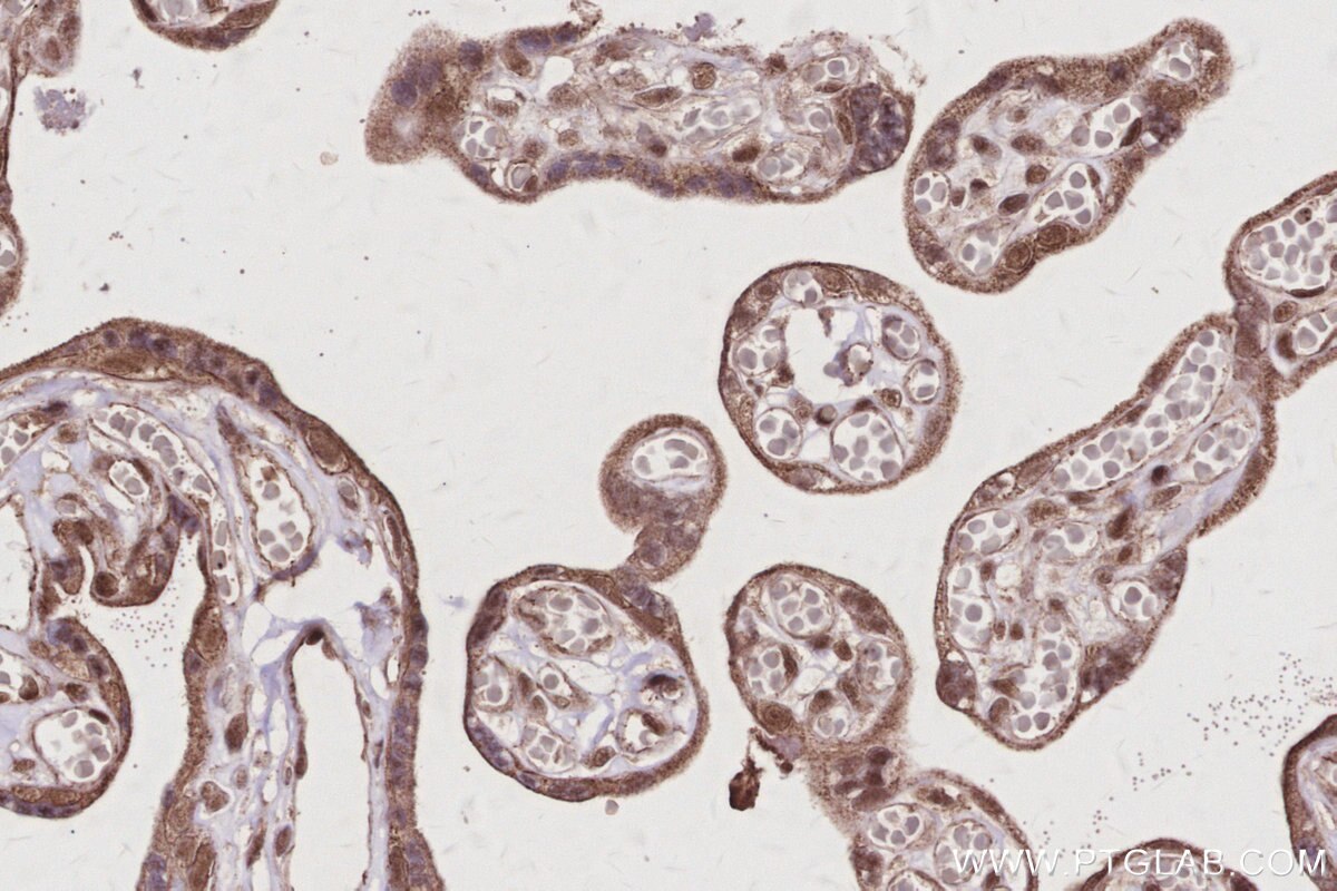 IHC staining of human placenta using 21761-1-AP Immunohistochemistry (IHC) staining of human placenta tissue using ANAPC7 Polyclonal antibody (21761-1-AP)