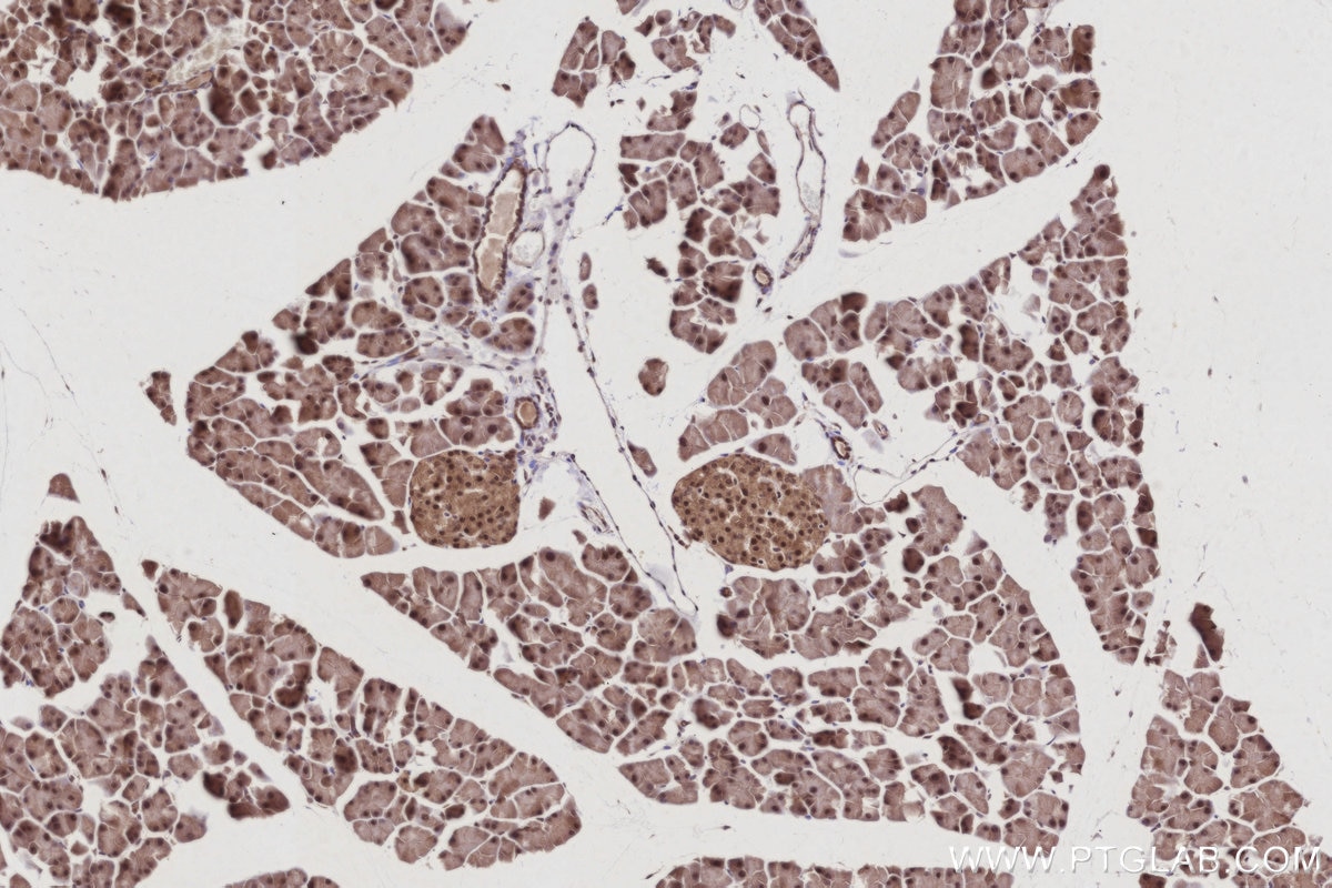 IHC staining of mouse pancreas using 21761-1-AP Immunohistochemistry (IHC) staining of mouse pancreas tissue using ANAPC7 Polyclonal antibody (21761-1-AP)