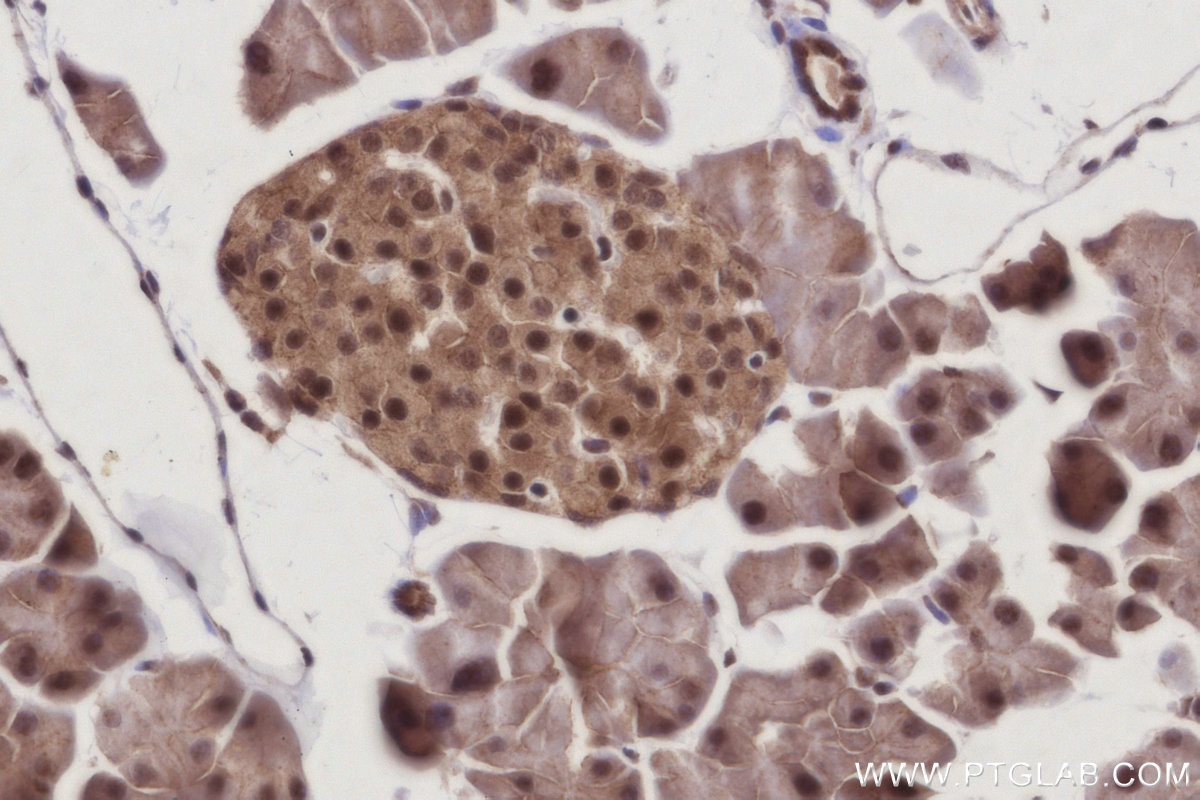 IHC staining of mouse pancreas using 21761-1-AP Immunohistochemistry (IHC) staining of mouse pancreas tissue using ANAPC7 Polyclonal antibody (21761-1-AP)