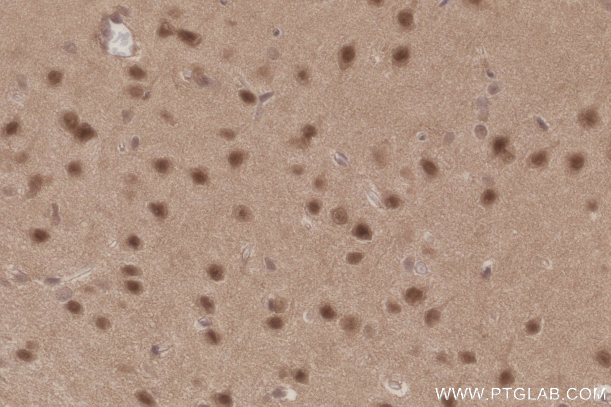 IHC staining of rat brain using 21761-1-AP Immunohistochemistry (IHC) staining of rat brain tissue using ANAPC7 Polyclonal antibody (21761-1-AP)