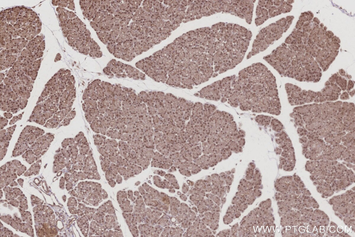 IHC staining of rat pancreas using 21761-1-AP Immunohistochemistry (IHC) staining of rat pancreas tissue using ANAPC7 Polyclonal antibody (21761-1-AP)