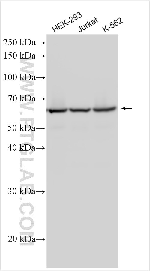 Western Blot (WB) analysis of various lysates using ANAPC7 Polyclonal antibody (21761-1-AP)