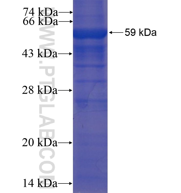 ANAPC7 fusion protein Ag16339 SDS-PAGE
