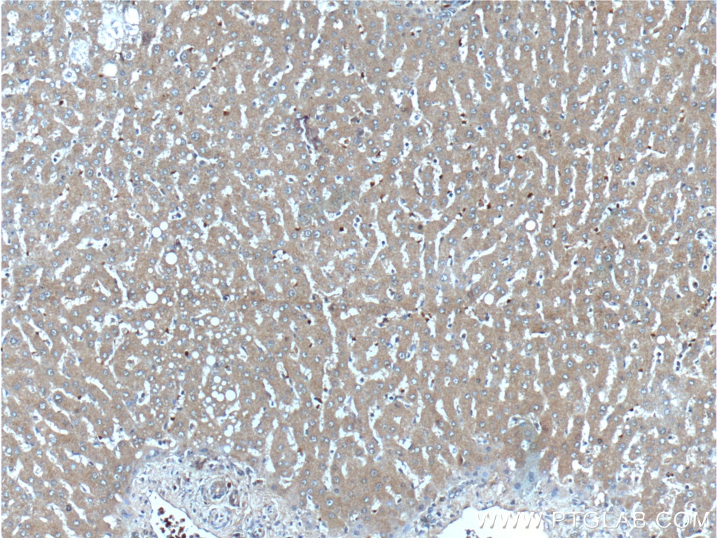 Immunohistochemistry (IHC) staining of human liver tissue using Angiogenin Polyclonal antibody (18302-1-AP)