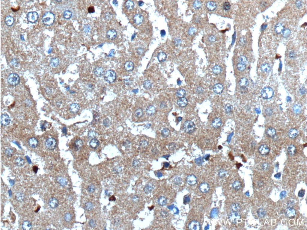 Immunohistochemistry (IHC) staining of human liver tissue using Angiogenin Polyclonal antibody (18302-1-AP)