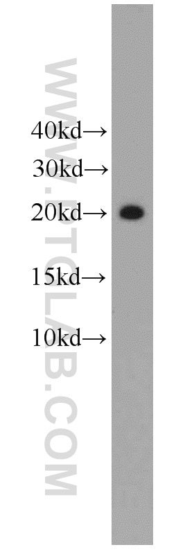 WB analysis of mouse liver using 18302-1-AP