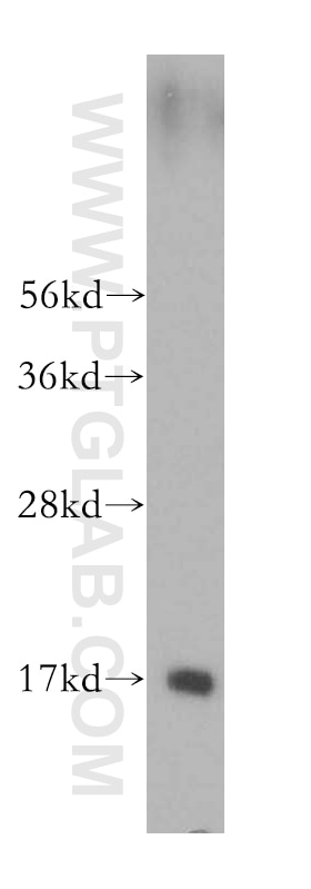 Angiogenin Polyclonal antibody