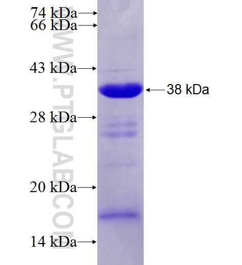 ANGEL1 fusion protein Ag27426 SDS-PAGE