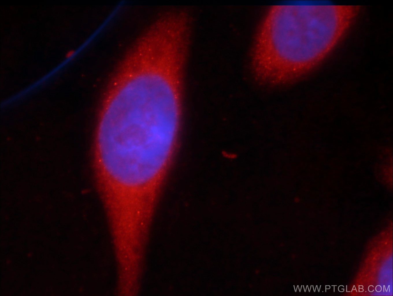 Angiopoietin 1