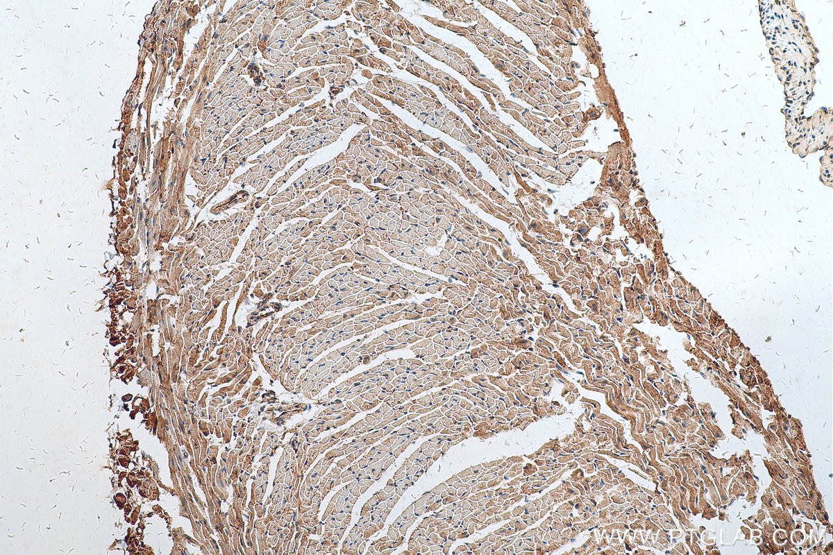 Immunohistochemistry (IHC) staining of mouse heart tissue using Angiopoietin 1 Polyclonal antibody (23302-1-AP)